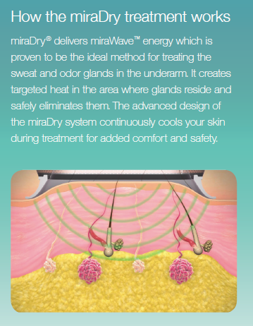 miraDry How It Works