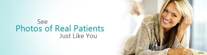 Plastic Surgery Services